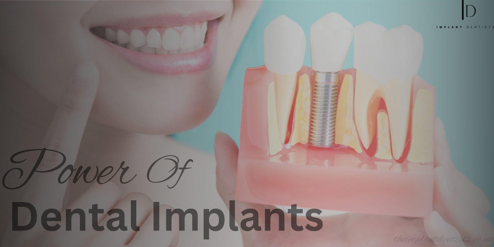 Enhance Your Smiles Through The Power of Dental Implants