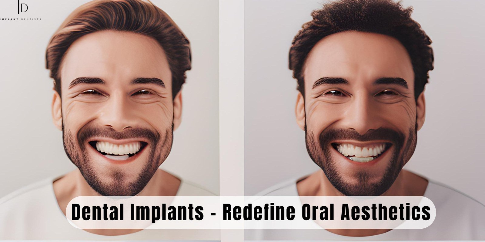 From Gaps to Grins: How Dental Implants Redefine Oral Aesthetics