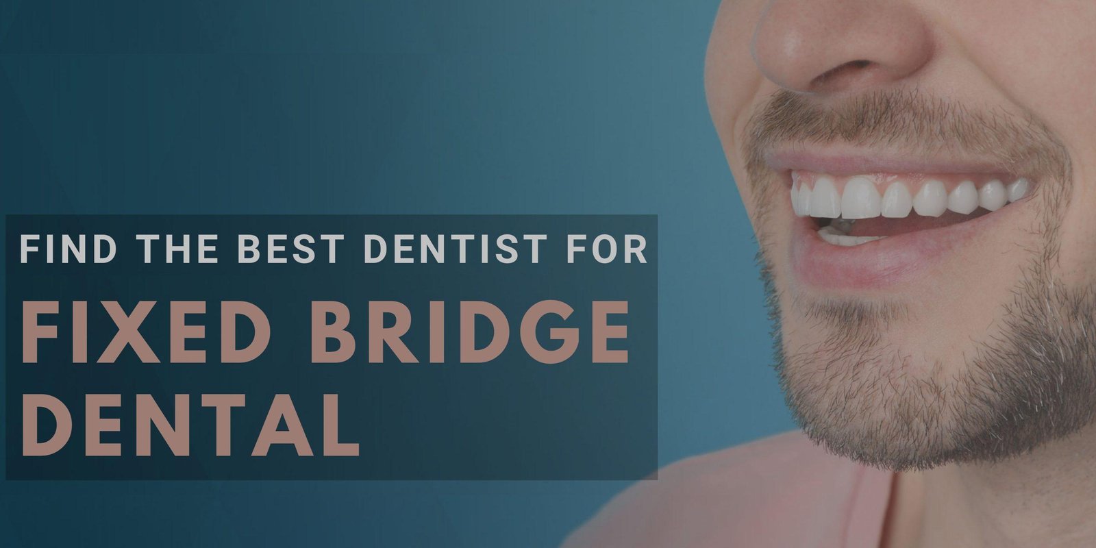 How to Find a Good Dentist for Fixed Bridge Dental