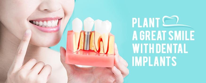 Enhance Your Quality of Life with All of Four Implants in the UK
