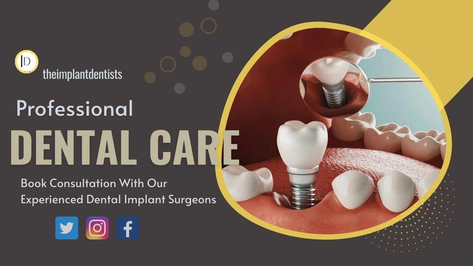 The Implant Dentists: Your Premier Destination for Tooth Replacement Solutions