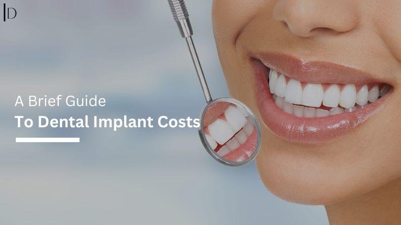 Guide to Dental Implant Costs in the UK: Your Questions Answered