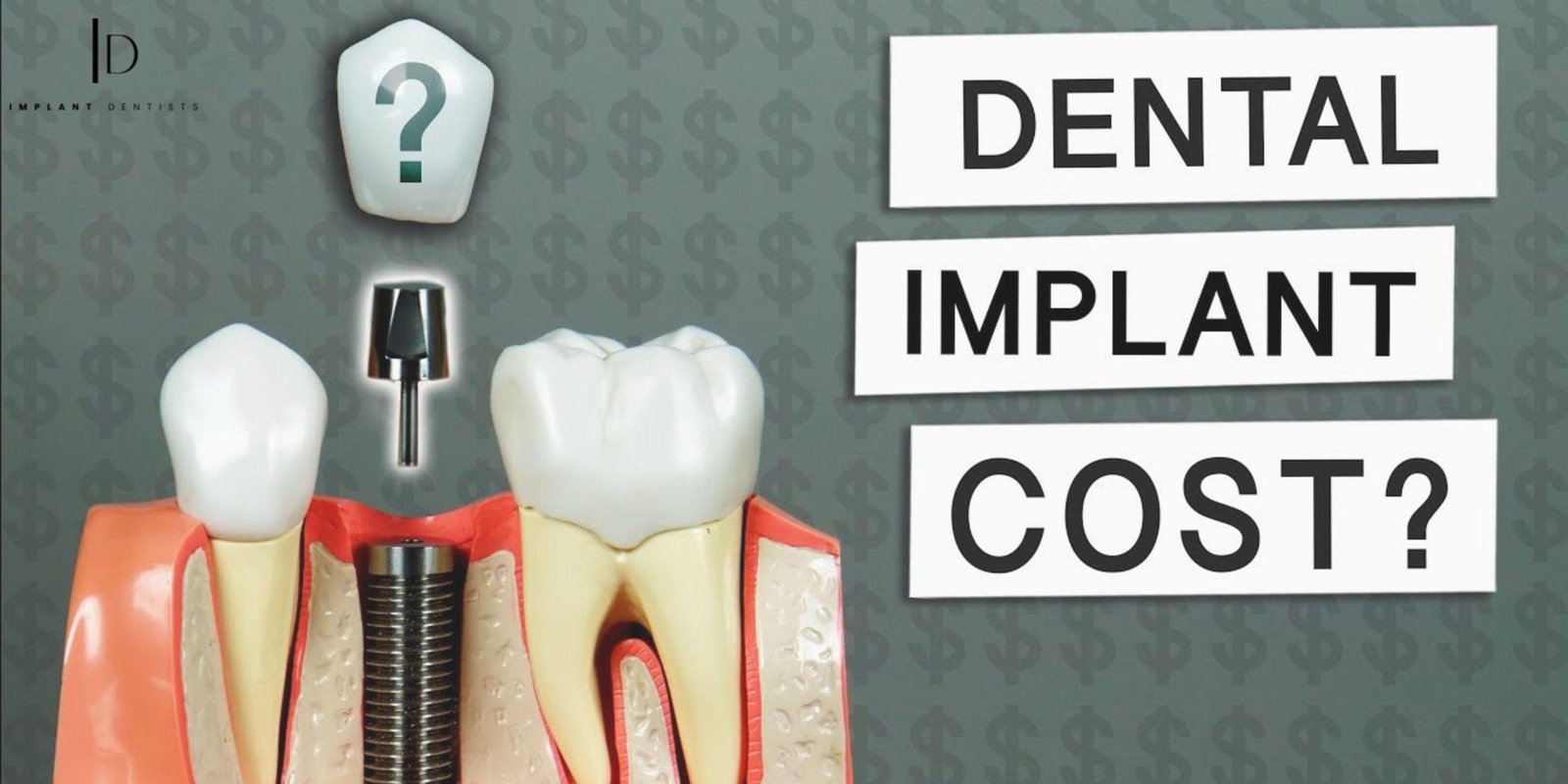 What Factors Influence the Cost of Dental Implants?