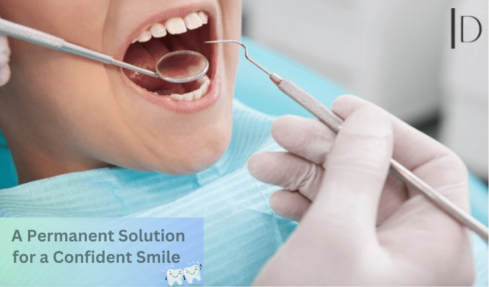 Fixed Teeth: A Permanent Solution for a Confident Smile