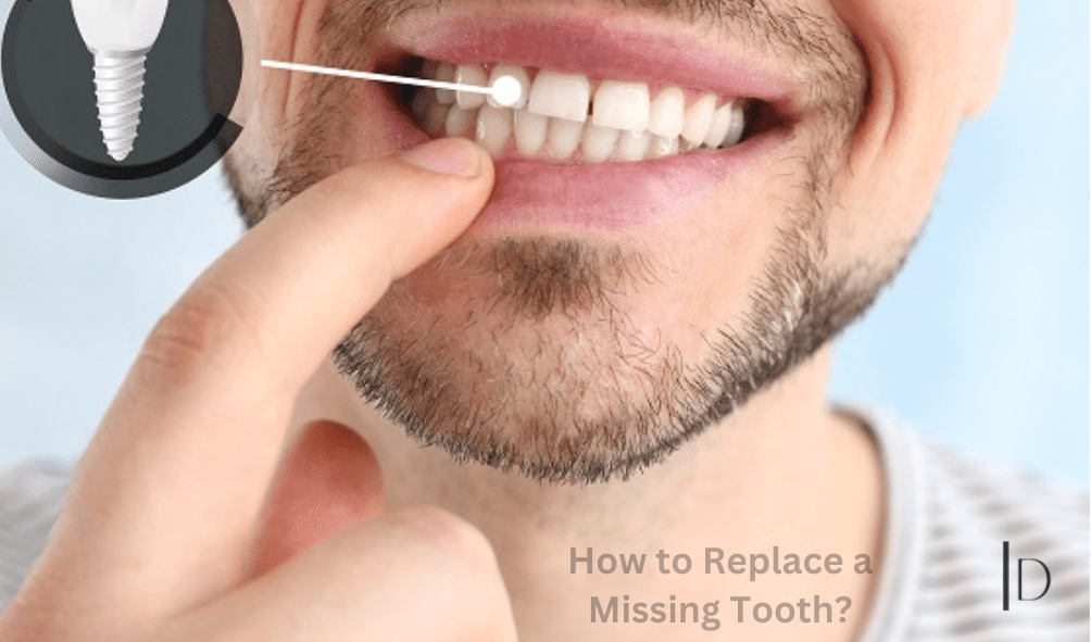 How to Replace a Missing Tooth | Affordable Smile Restoration