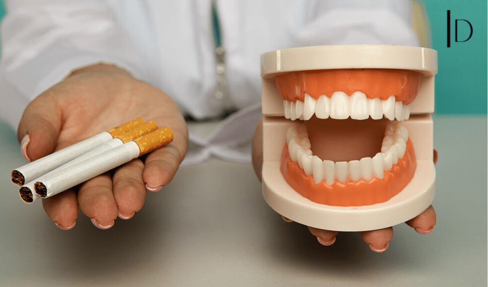 Smoking and Dental Implants: Can You Have Both?